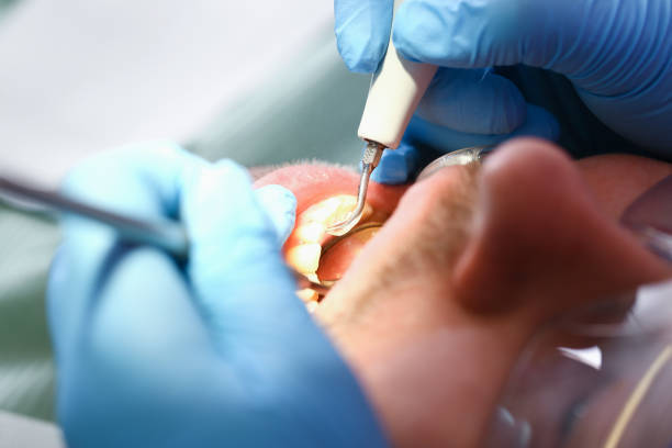 Best Cracked Tooth Emergency Dentist  in USA